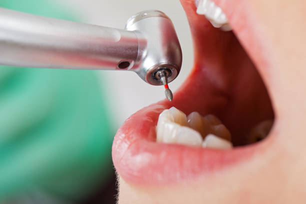 Best Emergency Dental Care for Broken or Chipped Teeth in Winter Beach, FL